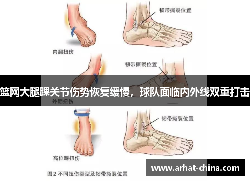 篮网大腿踝关节伤势恢复缓慢，球队面临内外线双重打击